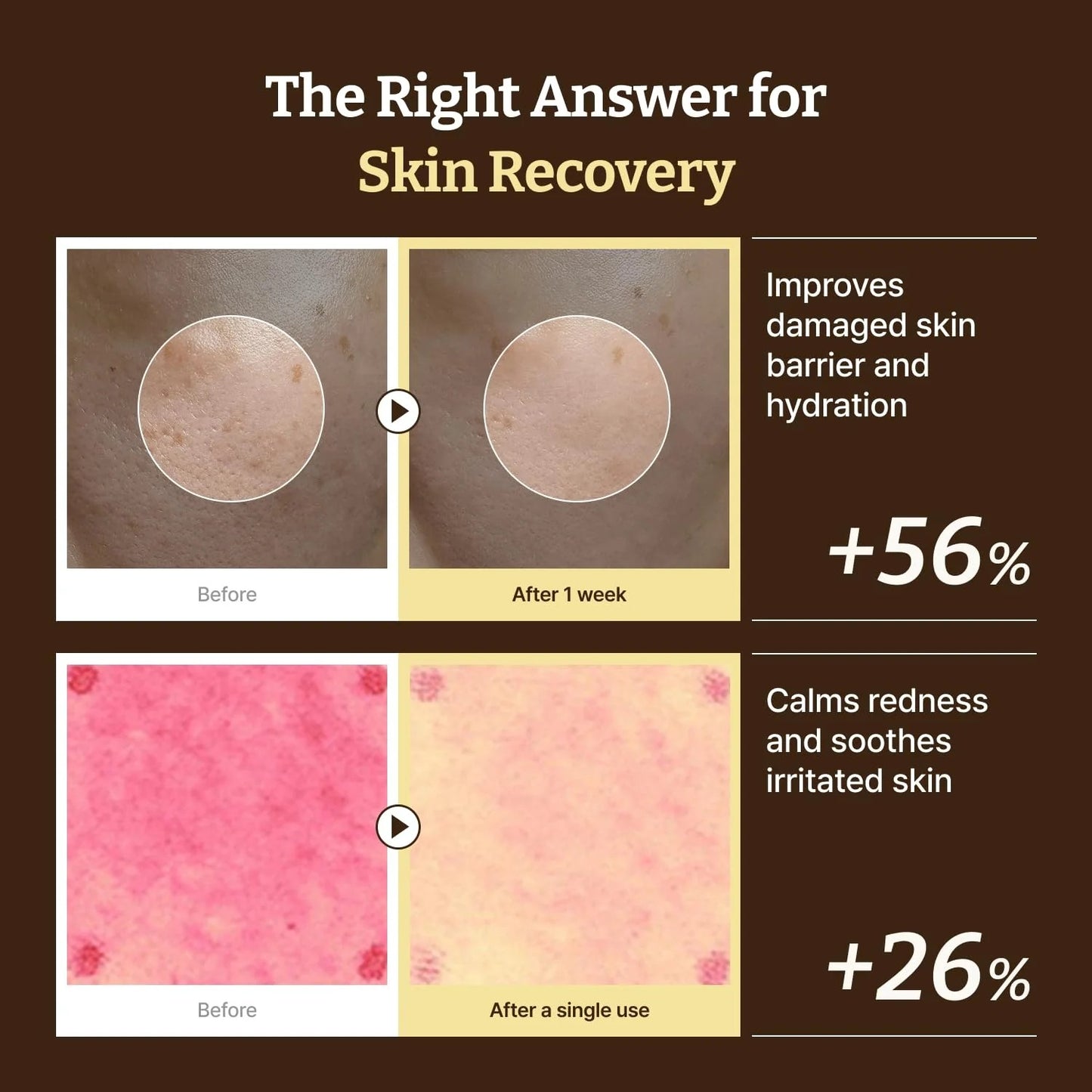 Before and after effects of a skin recovery product on skin texture and redness.