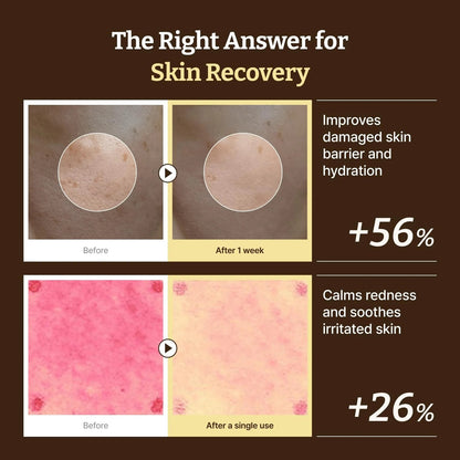 Before and after effects of a skin recovery product on skin texture and redness.