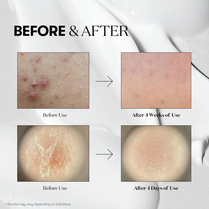 Before and after skin treatment results on a white background
