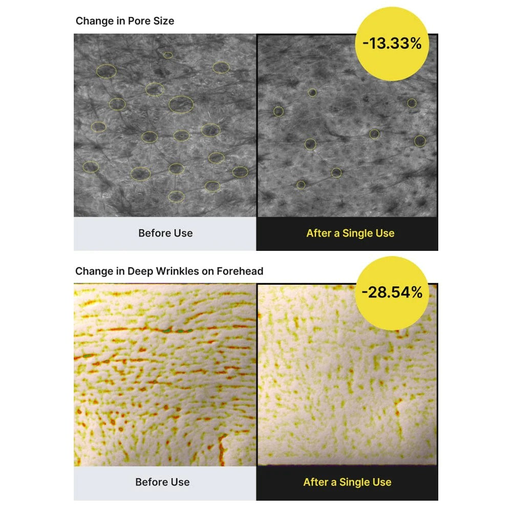 Before and after comparison of pore size and deep wrinkles on a forehead using a skincare product.