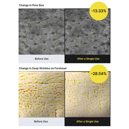 Before and after comparison of pore size and deep wrinkles on a forehead using a skincare product.