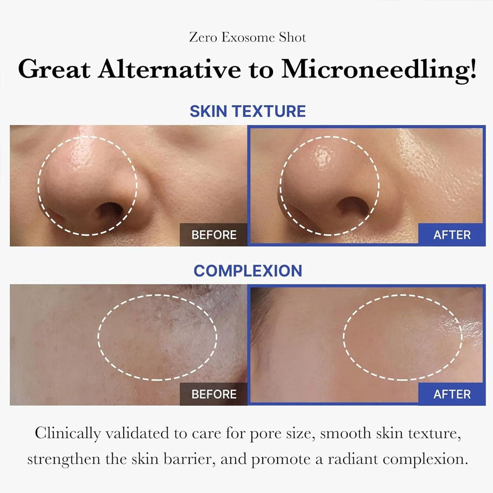 Medicube - One Day Exosome Shot Pore Ampoule 2000