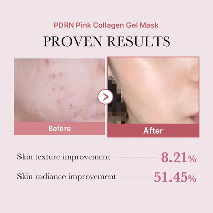 Medicube - PDRN Pink Collagen Gel Mask (4 Pack)